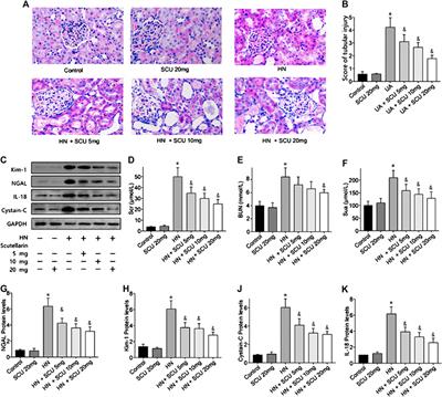 Scutellarin Ameliorates Renal Injury via Increasing CCN1 Expression and Suppressing NLRP3 Inflammasome Activation in Hyperuricemic Mice